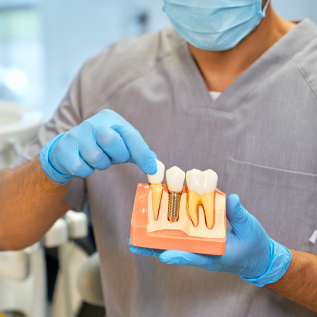 Implantes dentales exceldent
